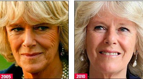duchess of cornwall before and after
