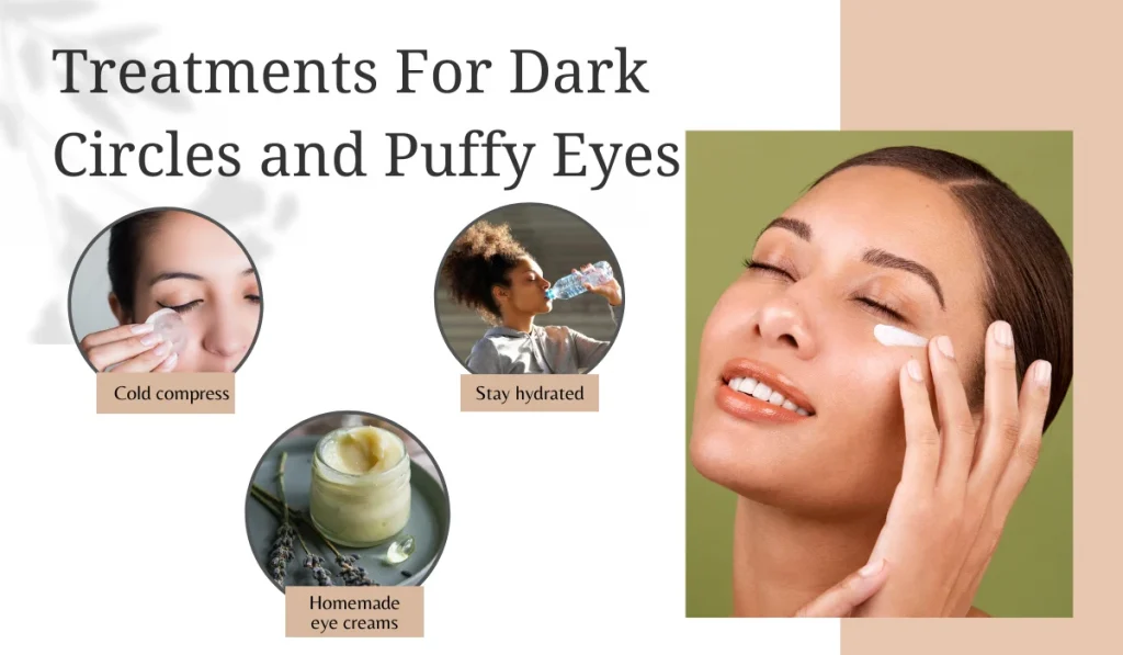Treatment For Curing Dark Circles and Puffy Eyes