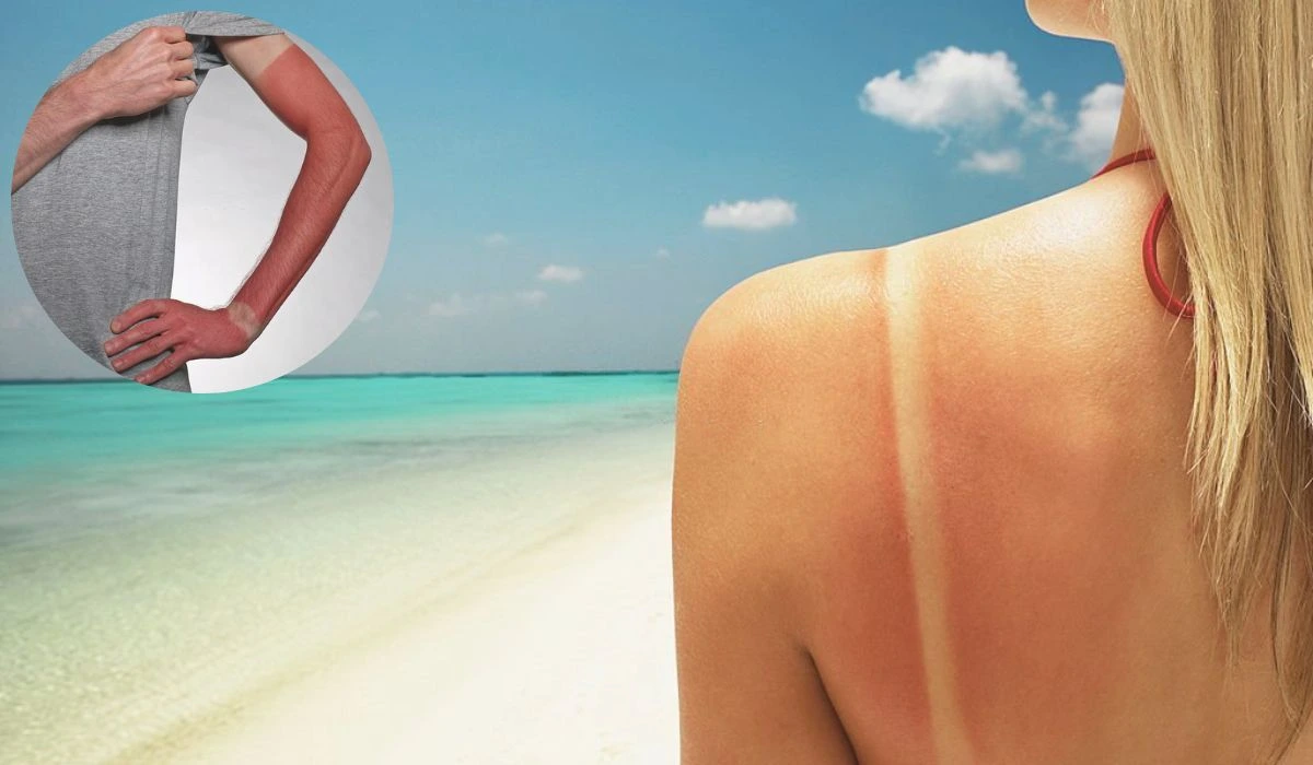 How To Reverse Sun Damage On The Skin Restore Your Skin Health