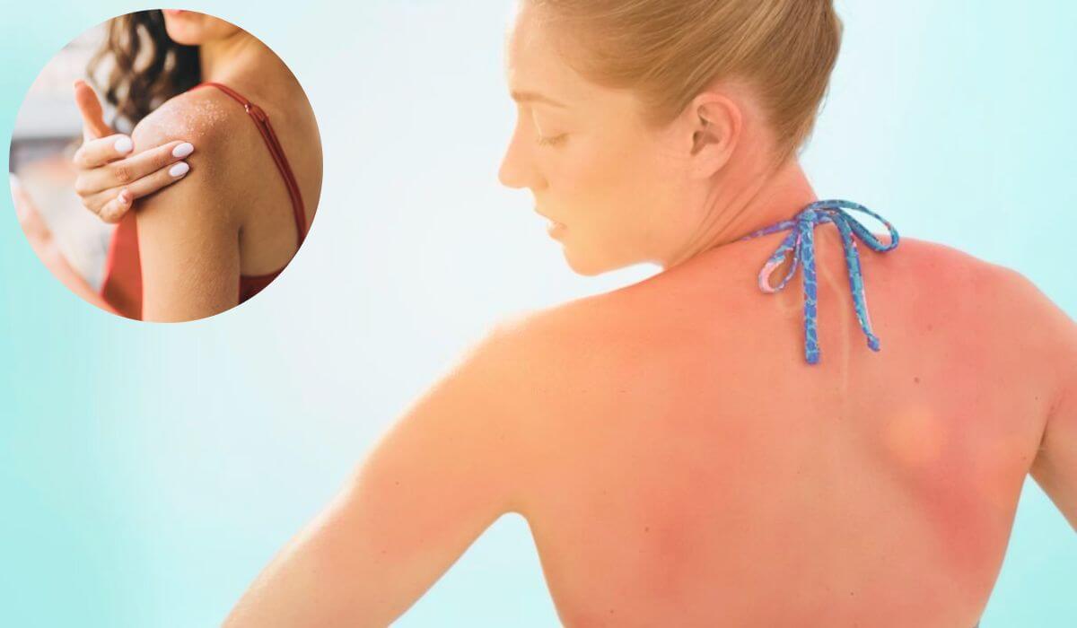 Reverse Sun Damage And Restore Your Skin Health
