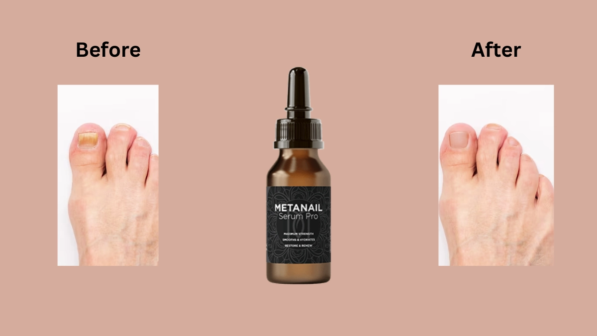 Metanail Serum Pro before and after